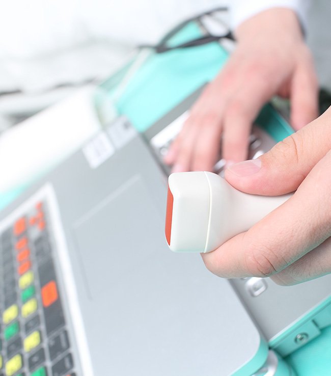 Stressechokardiografie Kardiologie Posthof Neuhausen